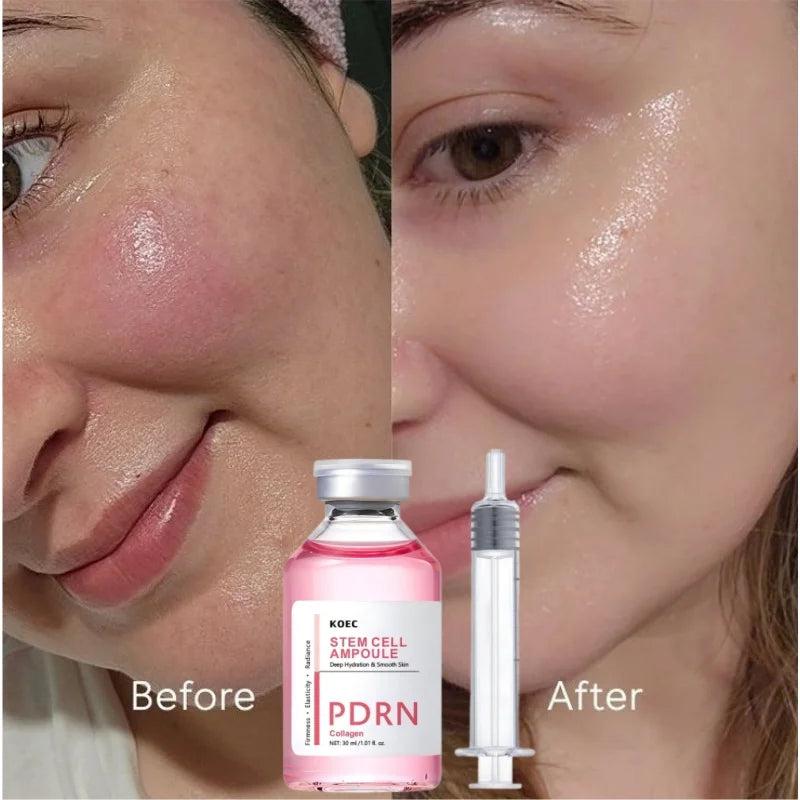 Pdrn Salmon Moisturizing Essence Collagen Blue Copper Peptide Deeply Moisturize Improve Dry Dull Firm Skin Korean Skincare New