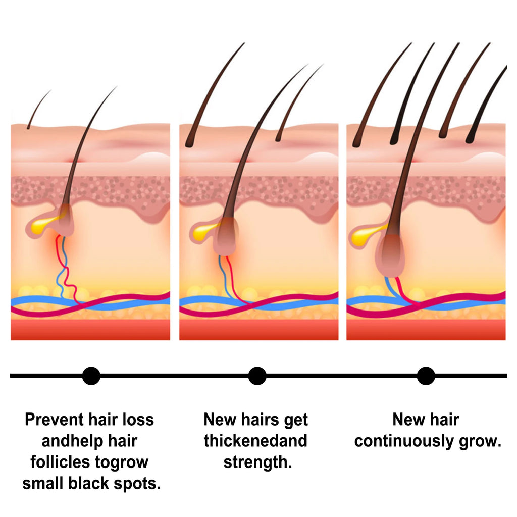 Fast Hair Growth Oil Africa Crazy Traction Treatment Hair Loss Spray Hair Regrowth Powerful Hair Root Repair Hair Mask Hair Care