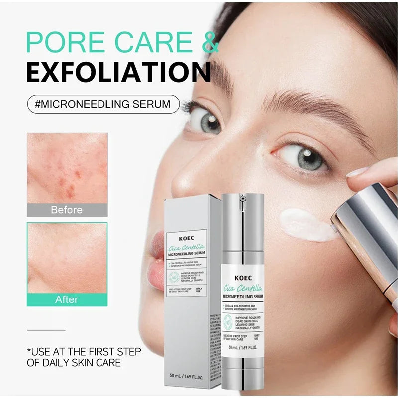 Korean Collagen Microneedle Serum Hydrating Soothing Brighten Facial Essence Dragon Blood Centella Asiatica Repair Skin Serum