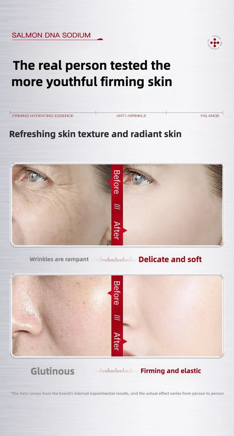 Effective Korea 5ml Salmon DNA  Ampoule Skin Booster Serum Kit Skin Whitening Moisturizing For 0.3mm Meso Serum Good Quality