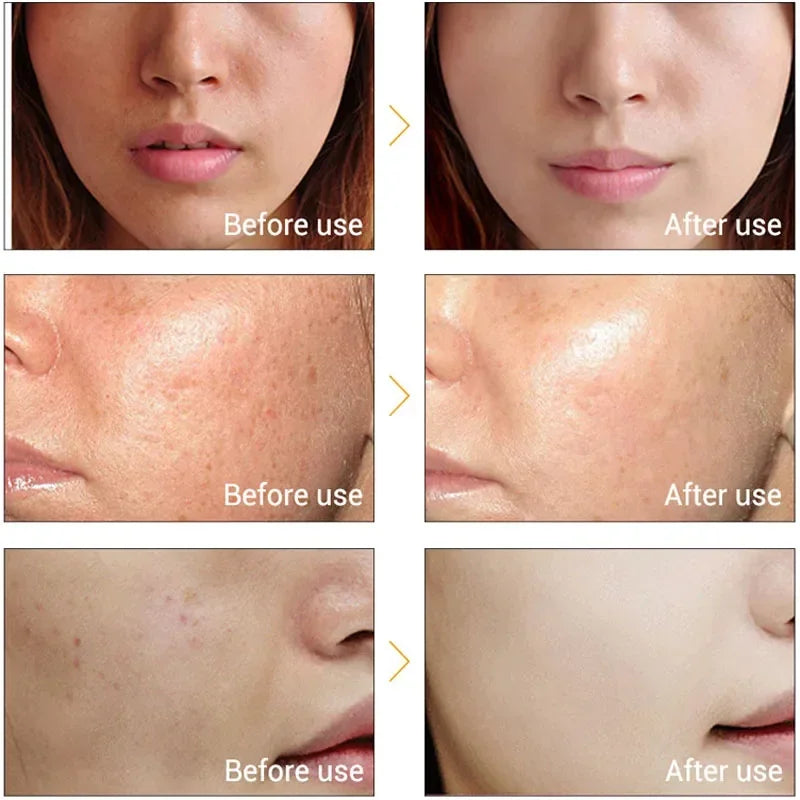 Electric Facial Beauty Device Ultrasonic Ionic Face Cleaner Anti-aging Machine High Frequency Wrinkle Removal Skin Lift Massager