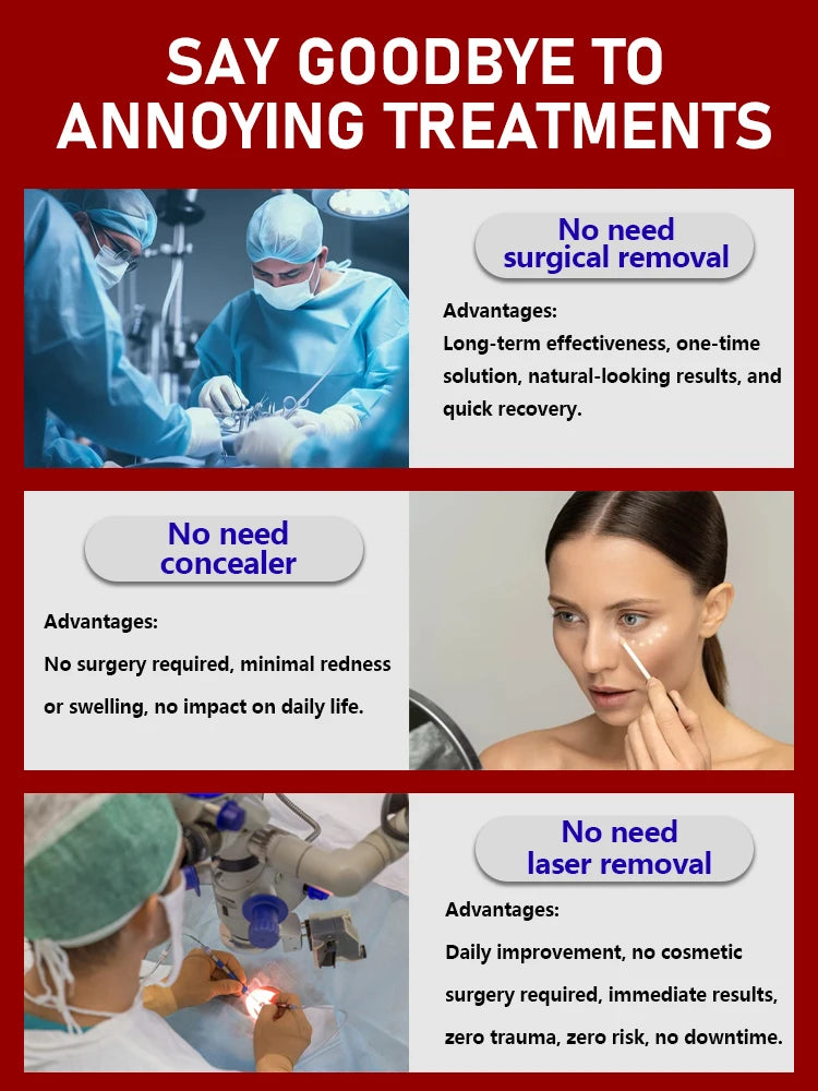 2026 Bestselling Eye Care Tool - Eye Revitalizing Cream (Free Shipping)