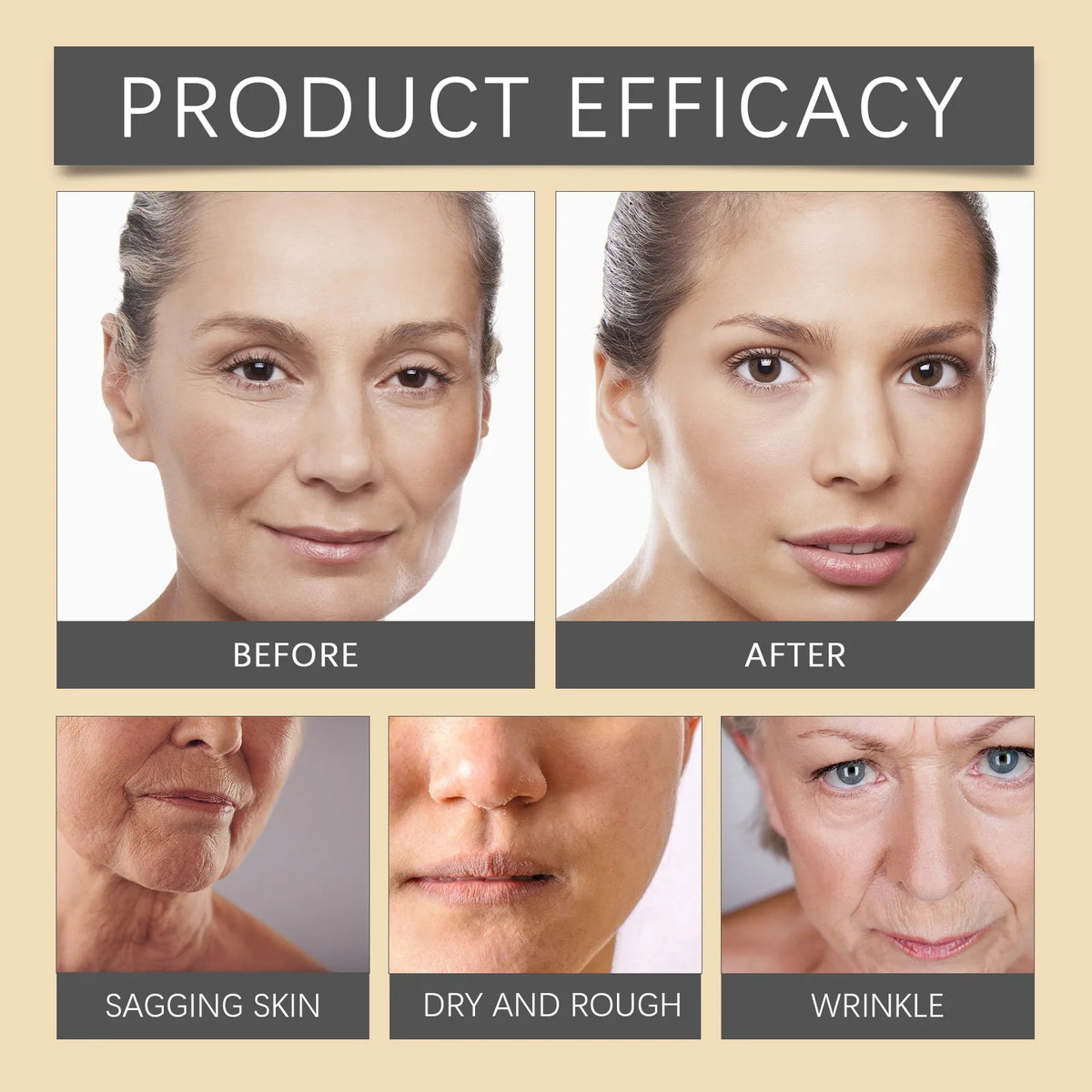 Bee Venom Wrinkle Removal Cream Firming Lifting Facial Moisturizing Deep Hydration Smoothing Fine Lines Anti Aging Face Cream