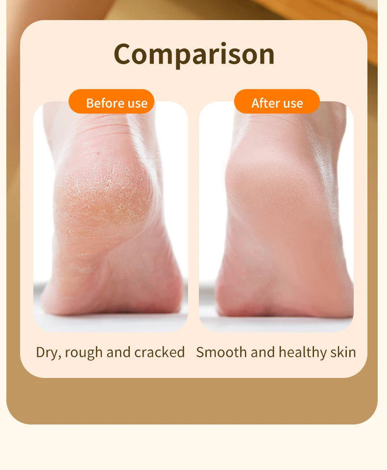 HOMEFISH Electric Foot Grinder Automatic Foot Callus Rubbing Pedicure Dead Skin Callus Remover for  Foot Beauty Machine