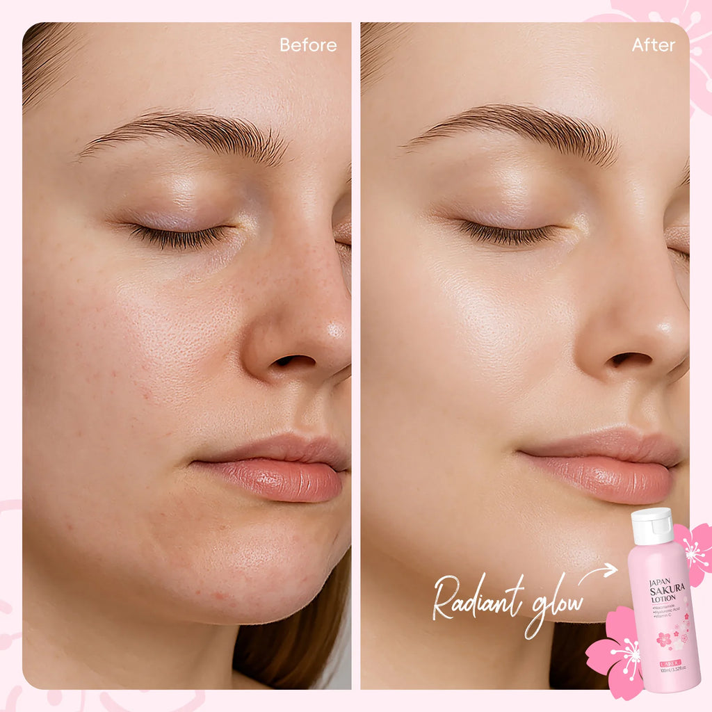 LAIKOU Sakura Lotion 100ml Niacinamide HA VC Hydrating Essence Shrink Pores Nourish Skin Brightening Elastic Facial Care