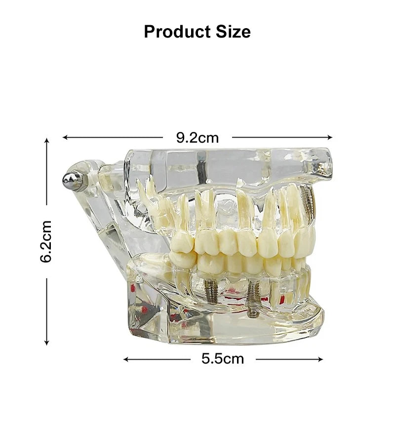 VVDental Teeth Repair Model Disease Teeth Model for Dentist Student Practice Training Studying Oral Medical Dentistry Tools
