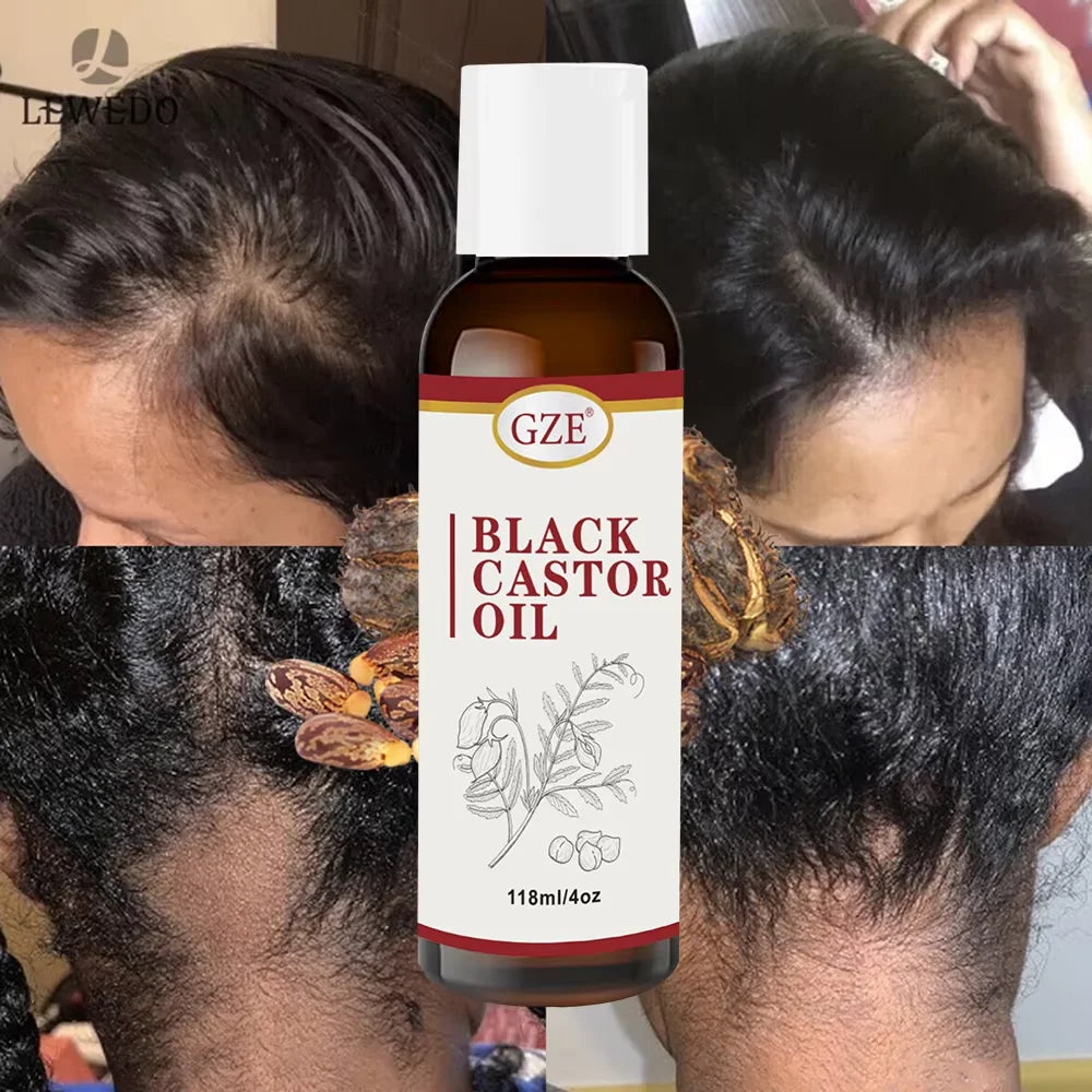 Jamaican Black Castor Oil for Hair Strengthens & Thickens | Body Care - Roasted & Cold-Pressed - Body Massage Oil for Hair