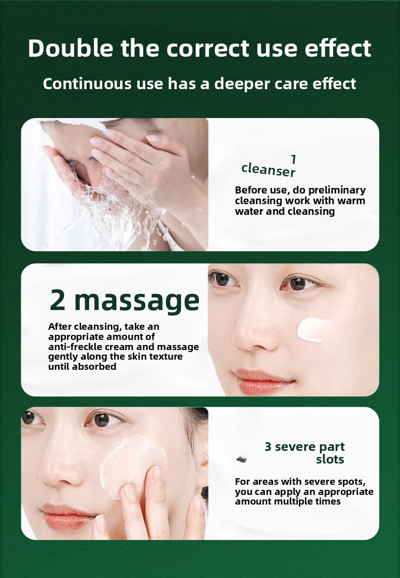 Whitening and freckle removal cream: moisturizing, brightening, rejuvenating, whitening, improving dull skin