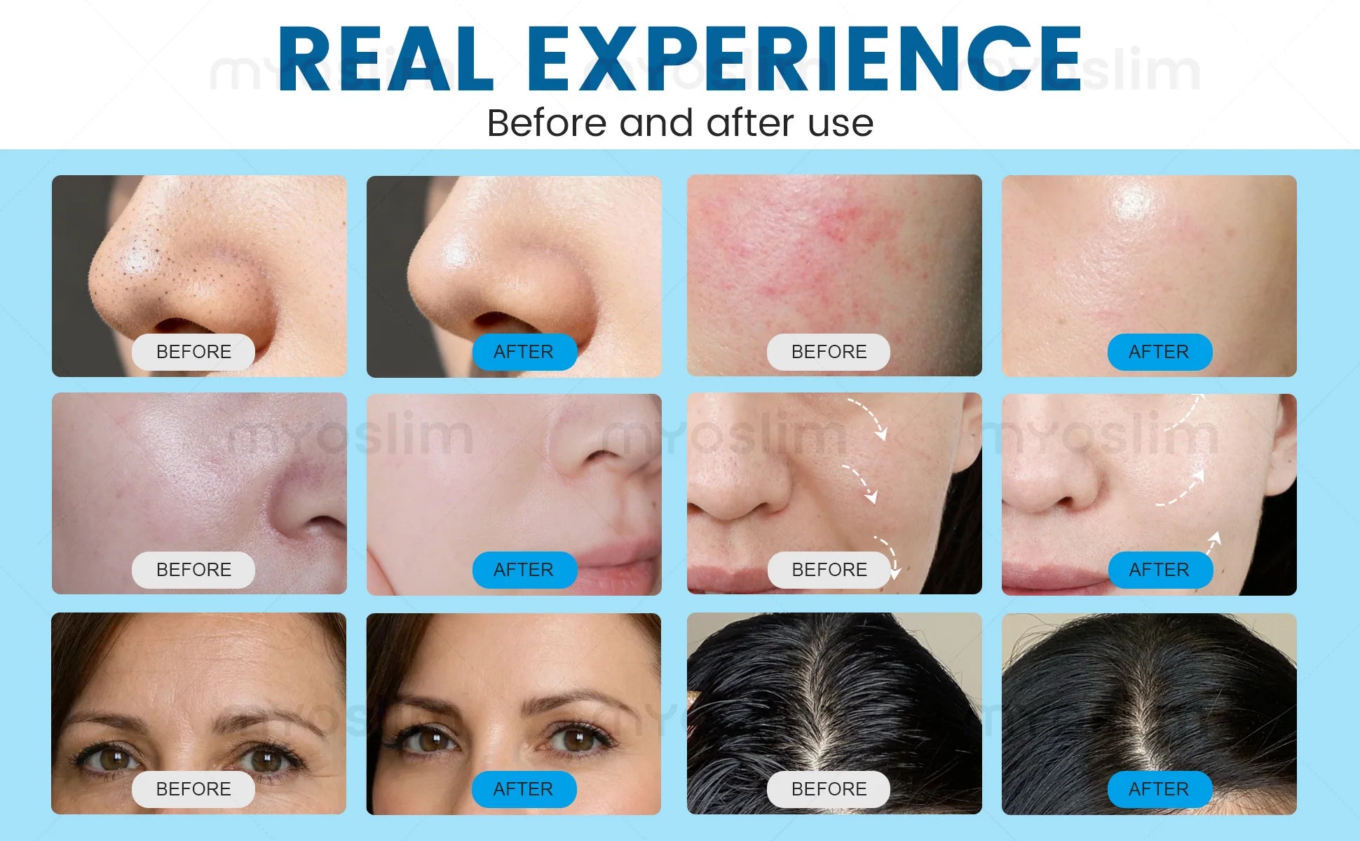 14 in 1 Hydro Beauty Skin Care Master Machine Deep Cleaning Blackhead Removal Skin Firming Brightening Shrink Pores Device