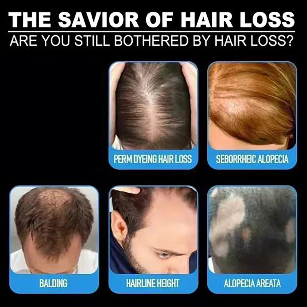 It strengthens hair and promotes hair growth simultaneously, resulting in strong, resilient hair that is not easily broken.