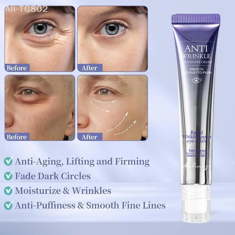 Neosfg Anti Wrinkle Anti Dark Circle Eye Cream Roller Massager Moisturizing Eye Bags Anti Aging Hyaluronic Acid Eye Skin Care