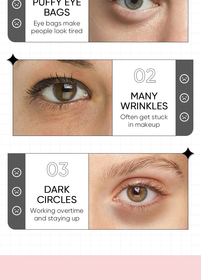 60 Pieces of Rose Starry Sky Collagen Eye Mask, Anti-Dark Circles, Anti-Eye Bags, Moisturizing and Firming Eye Patches, Eye Skin Care