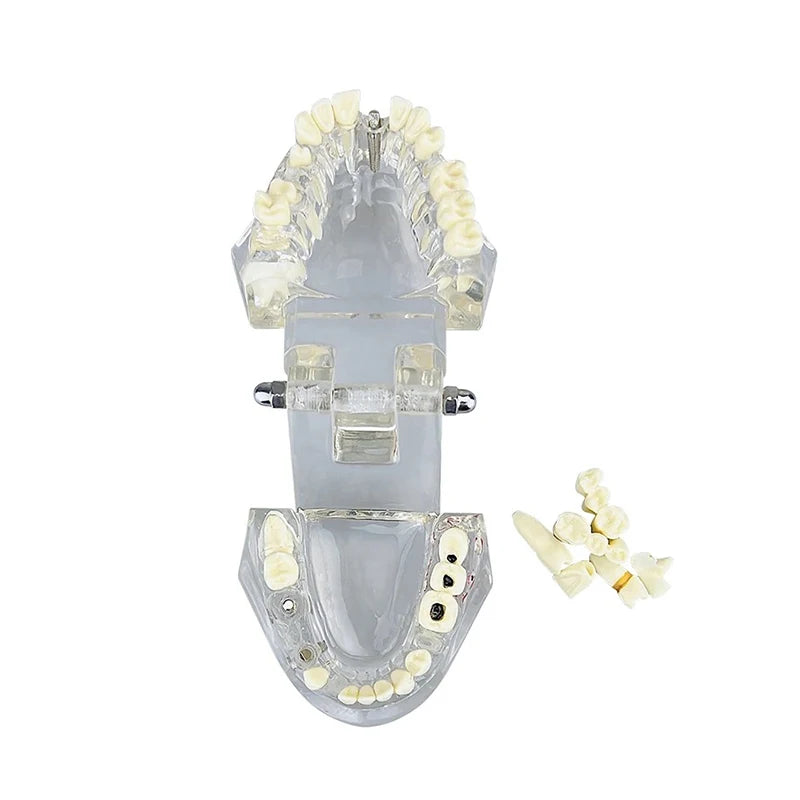 VVDental Teeth Repair Model Disease Teeth Model for Dentist Student Practice Training Studying Oral Medical Dentistry Tools