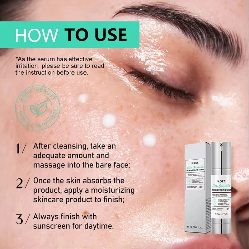 Powerful Spot-Removing Whiten Serum Brighten Skin Fast Eliminates Melanin Pigmentation Melasma Dark Spots Korean Face Skin Care