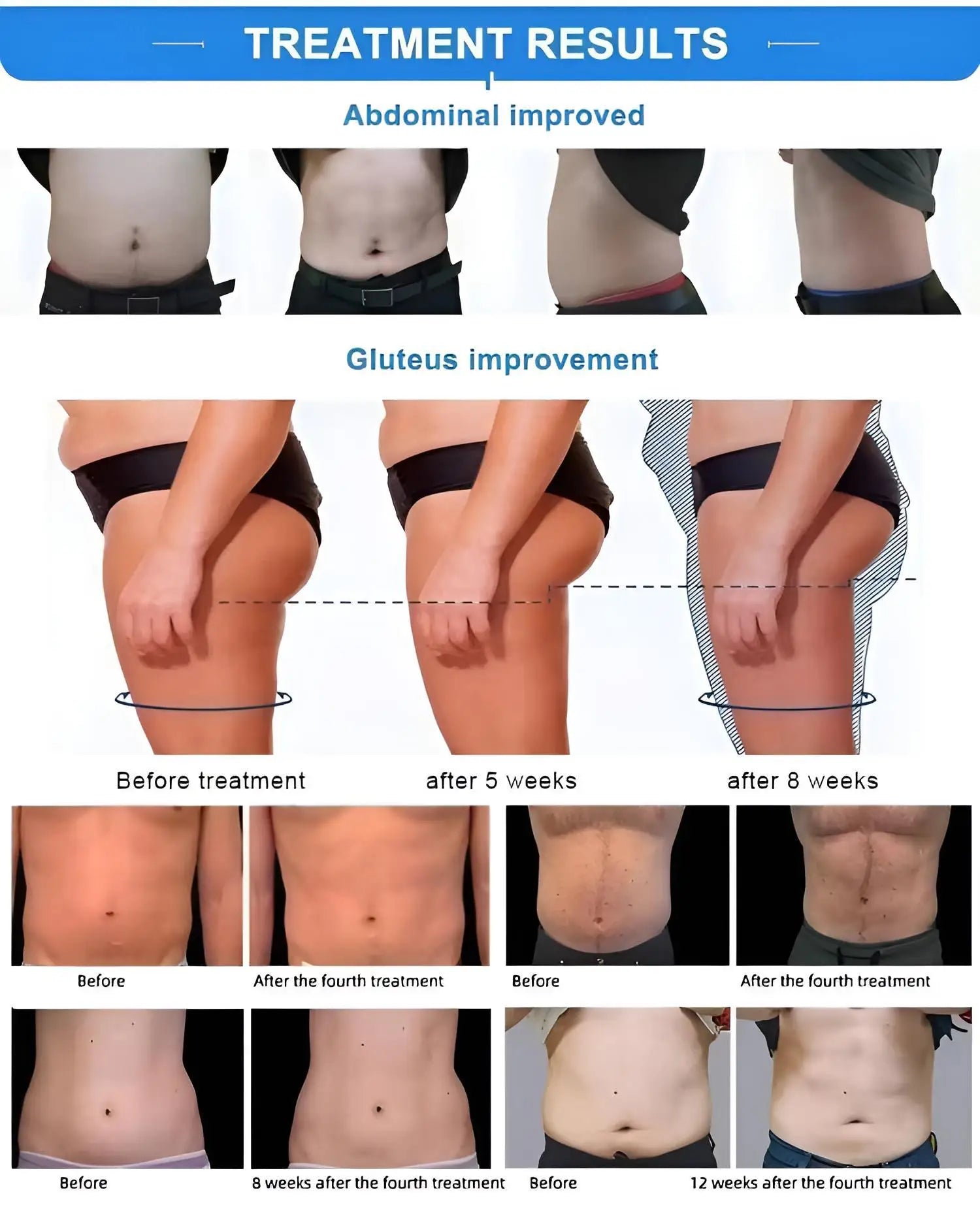 2026 Portable Body Slimming Machine Upgrade 15T Muscle Trainer RF for Home Use 36000 Contractions Session Portable Body Toner Fo