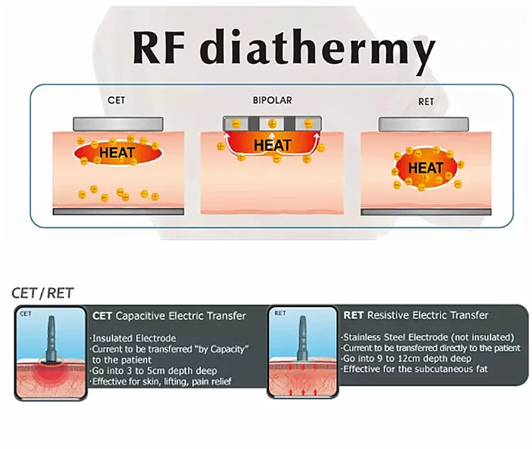 448KHZ Tecar Therapy RET CET JDM Diathermy Machine Pain Relief Body Sliming Weight Loss Skin Deep Health Care System Portable EC