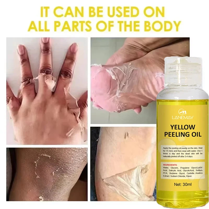 Yellow Peeling Oil Body Cleansing Exfoliation For Tender Glowing Skin Finger Joint Whitening Moisturizing Care Beauty Products