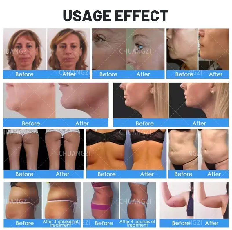 Salon-Grade Portable NEO Ultra 360 Slimming Machine 2 Handles Ultrasonic Fat Reducing Cellulite Wrinkle Removal Face Lift Devic