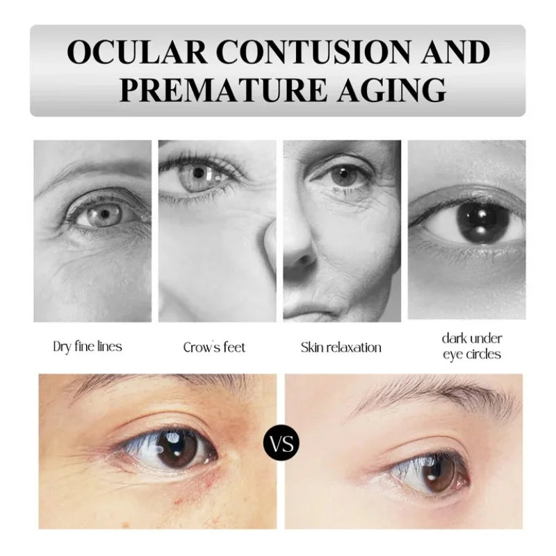 Snail Mucin Eye Cream Stick Wrinkle Removing Lightening Dark Circle Remove Eye Bag Anti-Puffiness Firming Fade Fine Lines