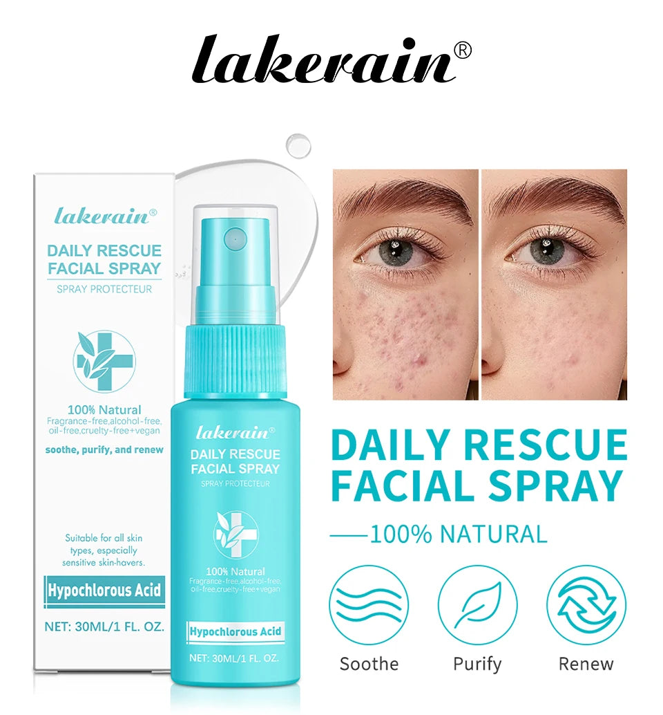 Calming Rescue Facial Spray For Sensitive Skin Hypochlorous Acid Spray Helps Reduce Redness Breakouts Soothing Balancing Spray