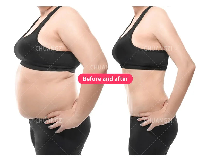EMS Body Sculpt Machine RF Sculpting Weight Loss Burning Fat Slimming Muscle Stimulation Equipment 6500W HI-EMT MYOslim