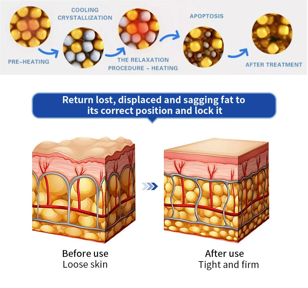 Professional Cryoskin Slimming Machine 2 Round Heads 2 Freezing Plates Skin Tightening Cellulite Removal Device