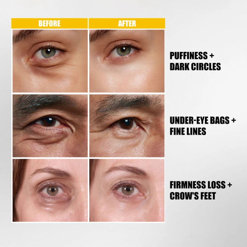 Retinol Volumetox Eye Cream Nad+PDRN Lifting-silk Essence 9+ Facial Cream Bio Lifting Essence Multi-peptide Brighten Skincare