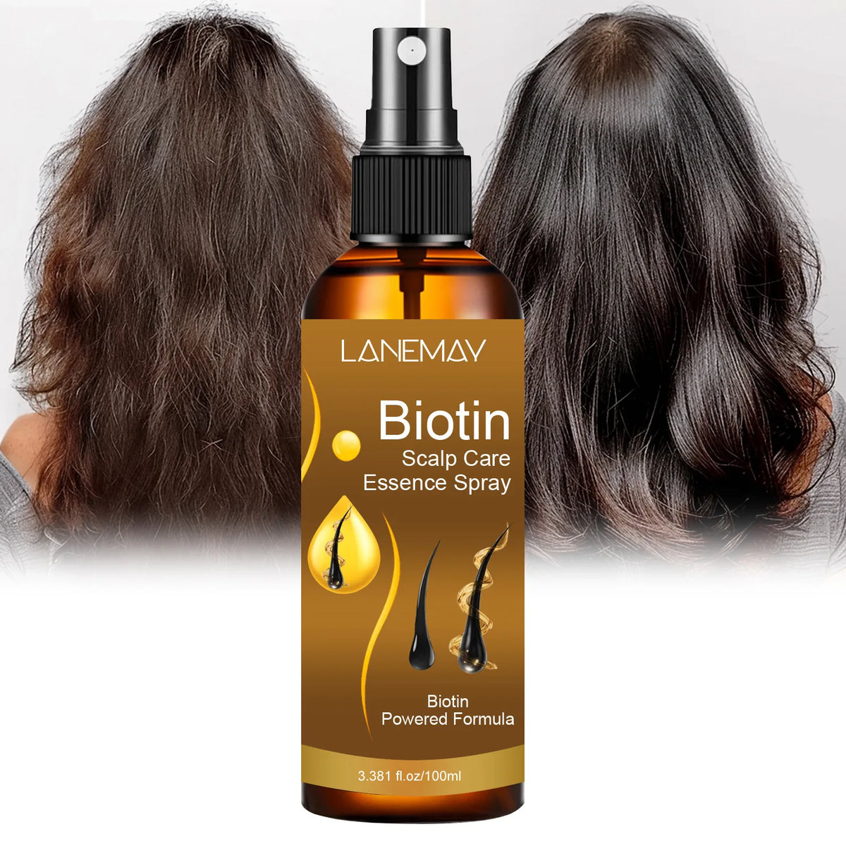 Biotin Scalp Care Essence Spray - Deeply Moisturizes, Hydrates and Protects Hair and Hair Follicles, Preventing Hair Loss 100ml