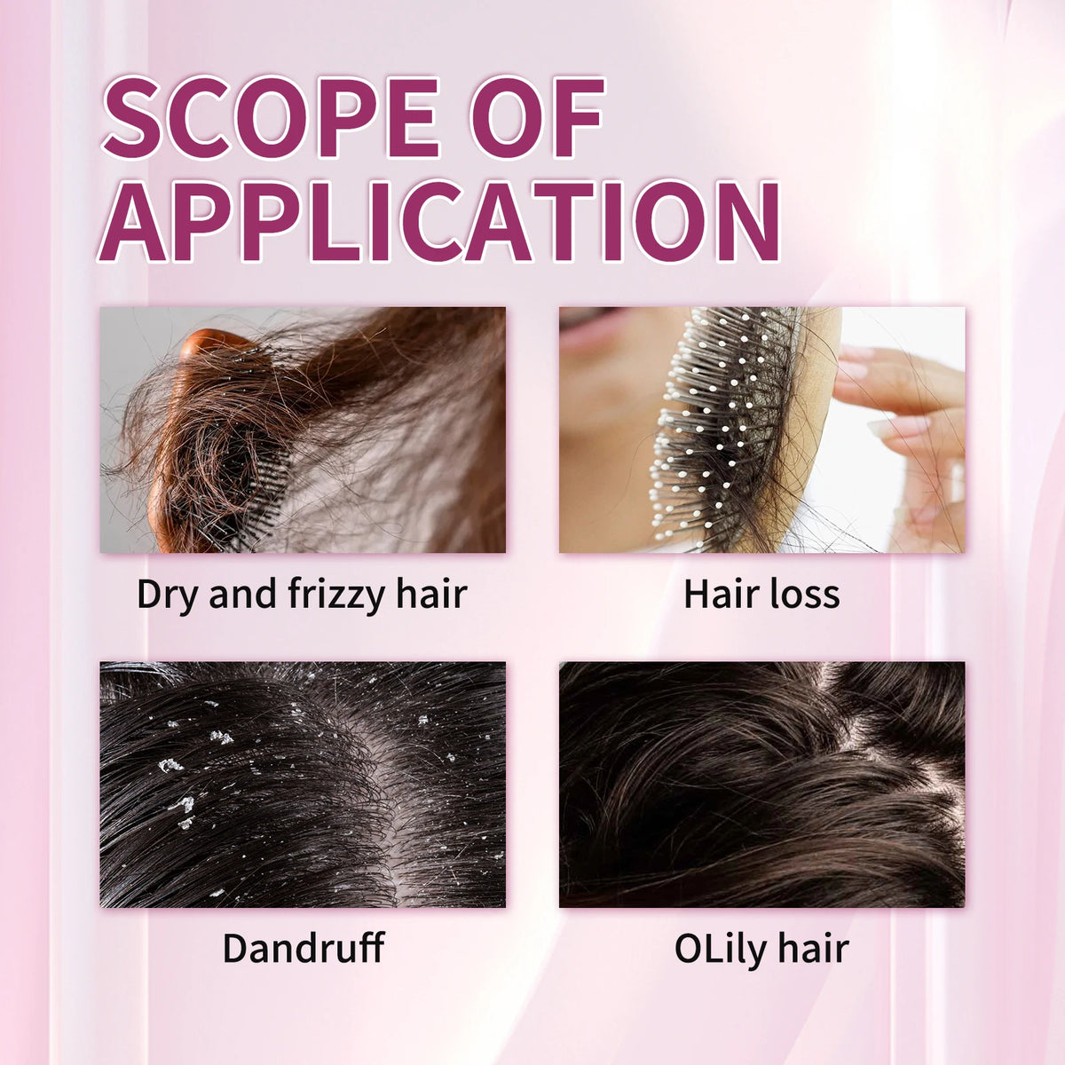 200ML Hair Shampoo Fast Hair Growth Rosemary Onion Hair Regrowth Shampoo Nourishing Anti Hair Loss Effective Hair Growth Product