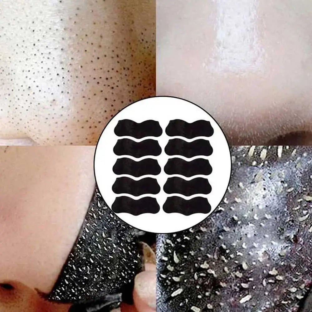 Black Nose Blackhead Remover Mask Deep Cleaning Shrink Pore Acne Treatment Mask Nose Black Head Remove Stickers Skin Care Mask