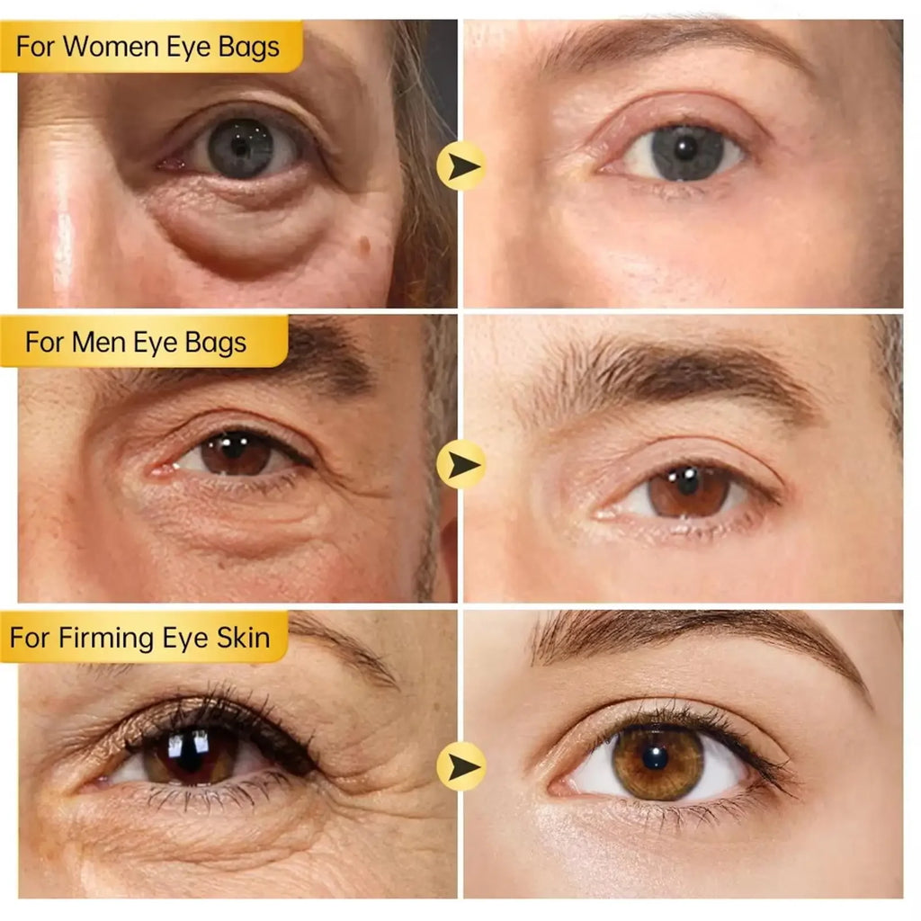 Anti Wrinkle Anti Dark Circle Eye Cream Roller Massager Moisturizing Eye Bags  Retinol Anti Aging Eye SkinCare Products O'CHEAL