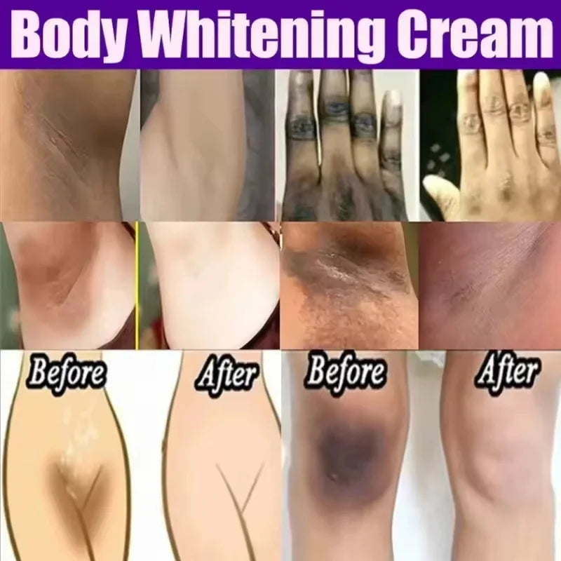 Whitening Cream Private Parts Underarm Bleaching Serum Whiten Butt Knee Brighten Inner Thigh Intimate Parts Dark Remove Melanin