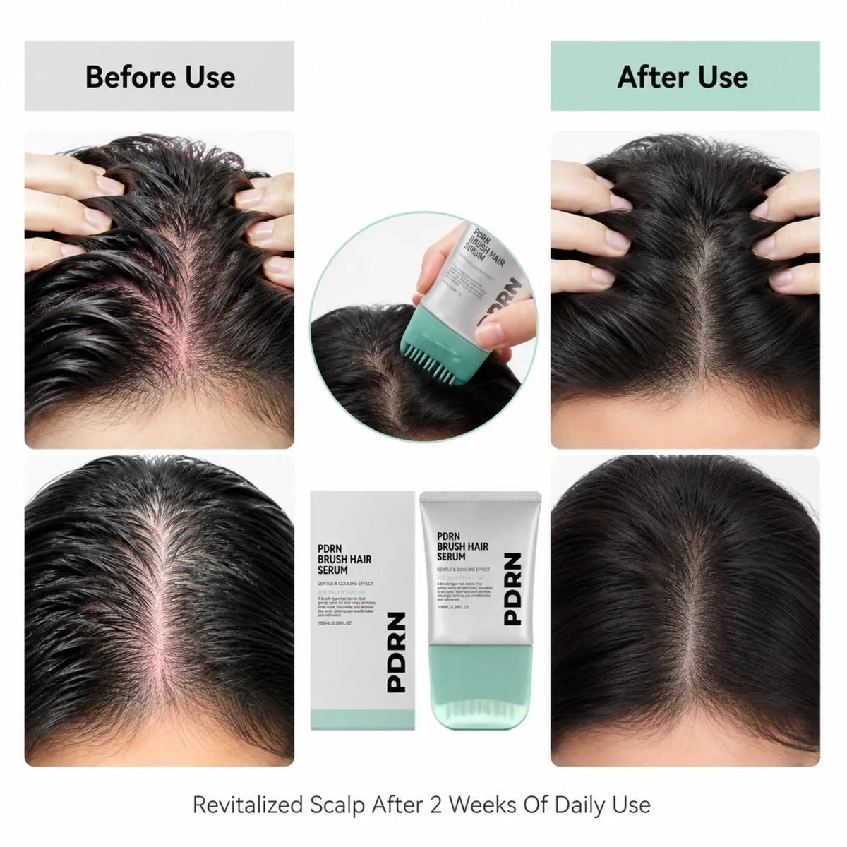 PDRN Hair Serum Cooling Brush Strengthen Hair Root Anti Hair Tired Scalp Nourishing Treatment for Scalp Massage Care Serum