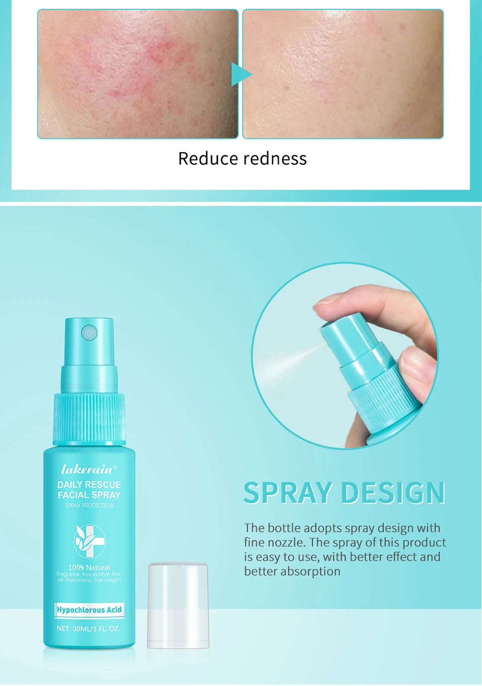 Calming Rescue Facial Spray For Sensitive Skin Hypochlorous Acid Spray Helps Reduce Redness Breakouts Soothing Balancing Spray