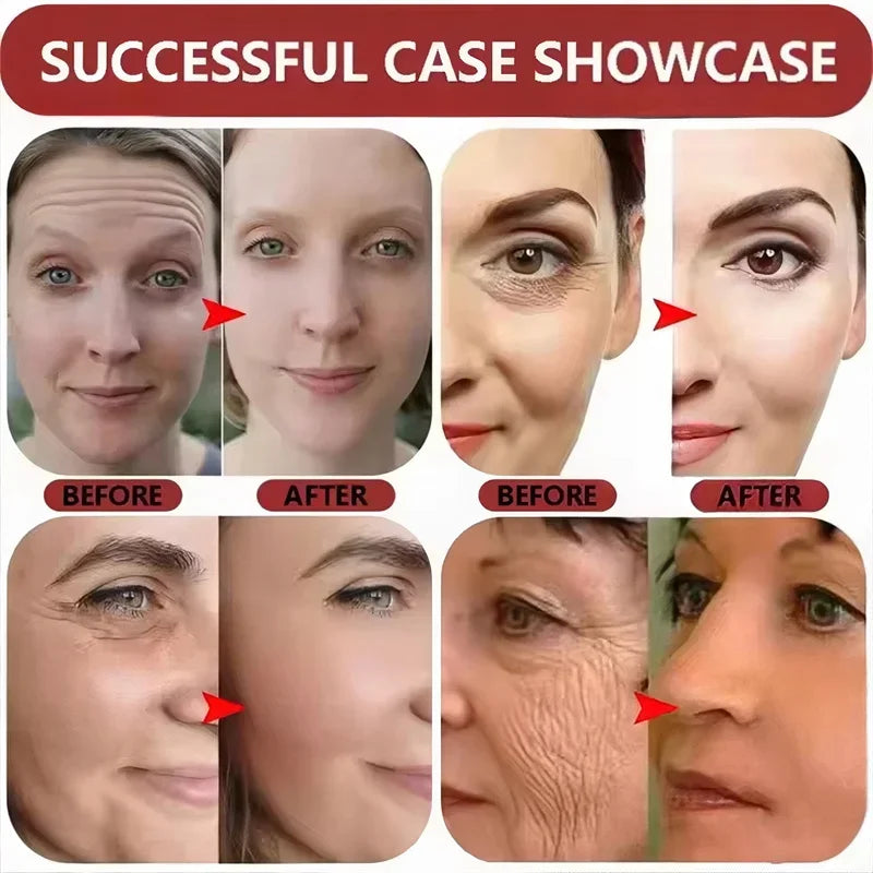 Retinol Anti-Wrinkle Face Serum Anti-Aging Lifting Firming Fade Fine Lines Improve Skin Dullness Moisturizing Care Beauty Health