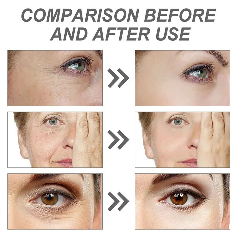 Retinol Anti-Wrinkle Face Serum Anti-Aging Lifting Firming Fade Fine Lines Improve Skin Dullness Moisturizing Care Beauty Health