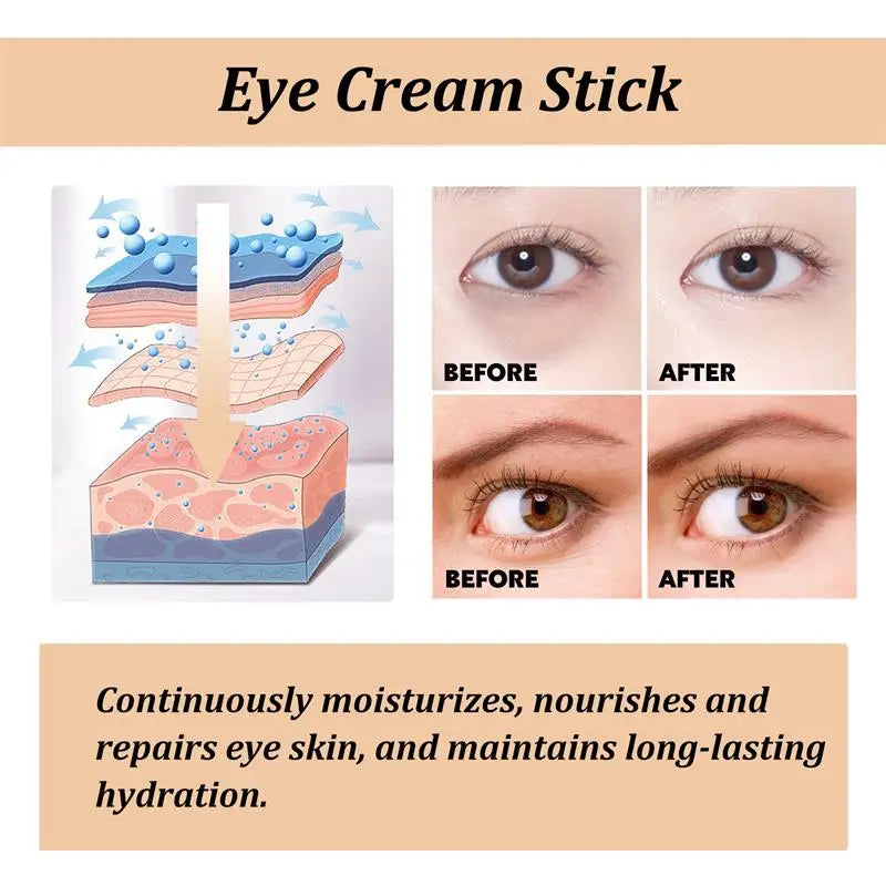 Snail Mucin Eye Cream Stick Wrinkle Removing Lightening Dark Circle Remove Eye Bag Anti-Puffiness Firming Fade Fine Lines
