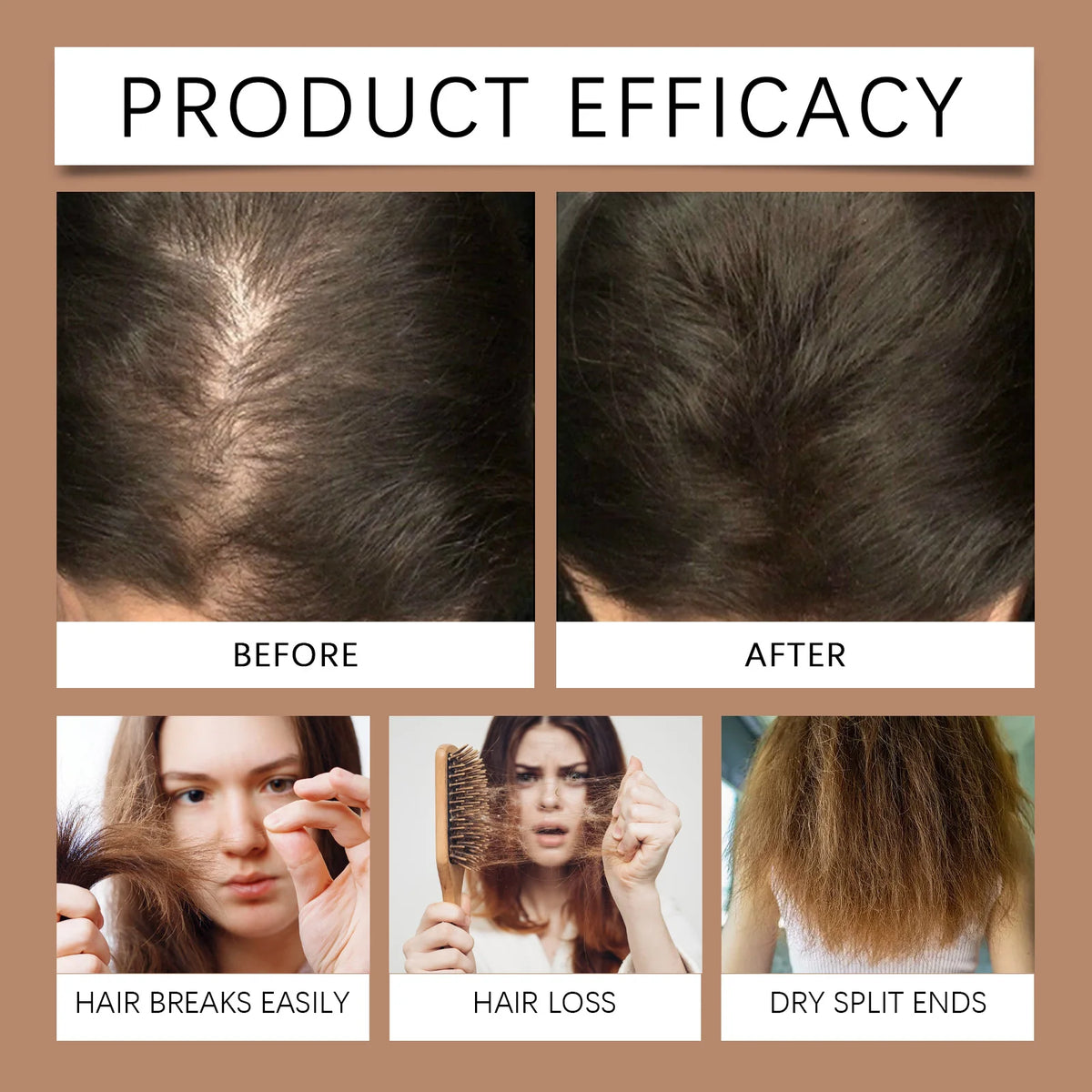 3 In 1 Batana Rosemary Onion Shampoo Deep Cleansing Remove Dandruff Soothe Scalp Anti Hair Loss Deep Nourish Hair Care Shampoo