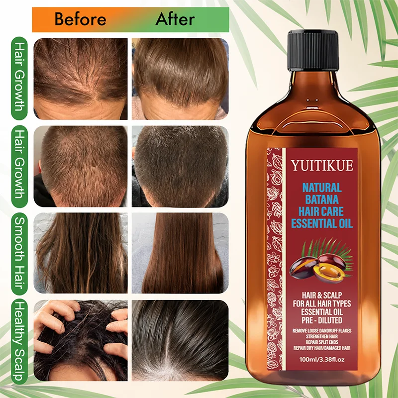 YUITIKUE Natural Batana Hair Essential Oil Scalp Care Anti Dandruff Strengthen Hair Repair Split Ends Dry Damaged Hair Anti-Friz