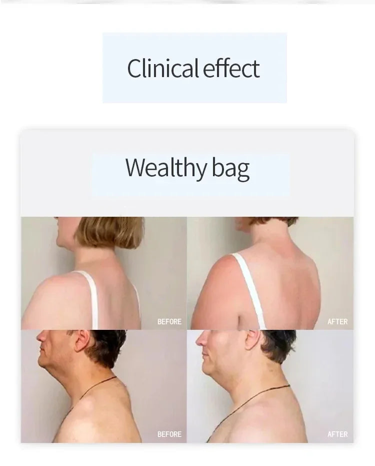 448KHz CET RET INDIBA Tecar Physical Therapy Physiotherapy Diathermy Pain Management Machine