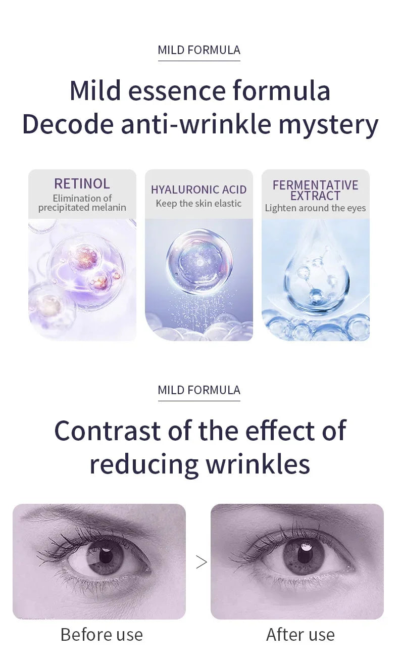 Anti Wrinkle Anti Dark Circle Eye Cream Roller Massager Moisturizing Eye Bags Anti Aging Hyaluronic Acid Eye Skin Care Products