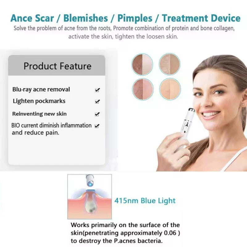 Facial Beauty Device Eye Blue Light Black Eye Circles Facial Care Tool Lightening Texture Maintaining Eye Bags