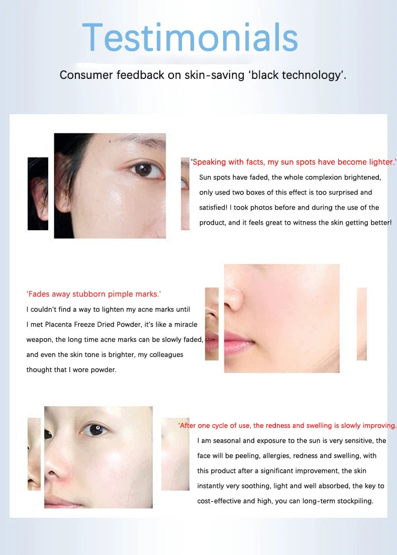 Facial Polypeptide Freeze-dried Powder Skin Booster 0.25mm Microneedle Serum Hydration Brightening Improve Elasticity Skin Care