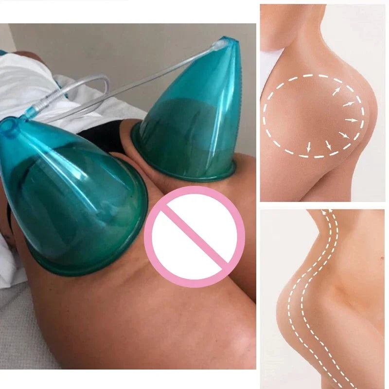 24 Cup Breast Enhancement Vacuum Massage Device Multifunctional Cupping And Scraping Beauty Device Colombine Body Shaping