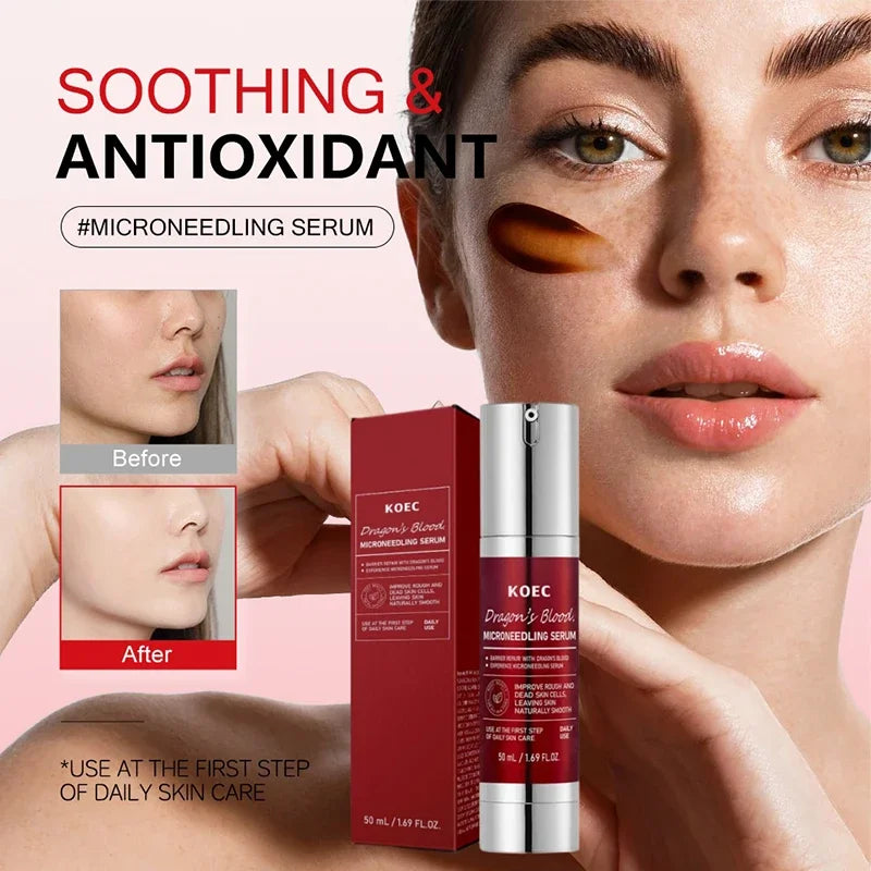 Soothing Microneedle Serum, Centella Asiatica & Propolis For Skin Barrier, Pore Care Exfoliating Korean Glass Skin Essence 50g