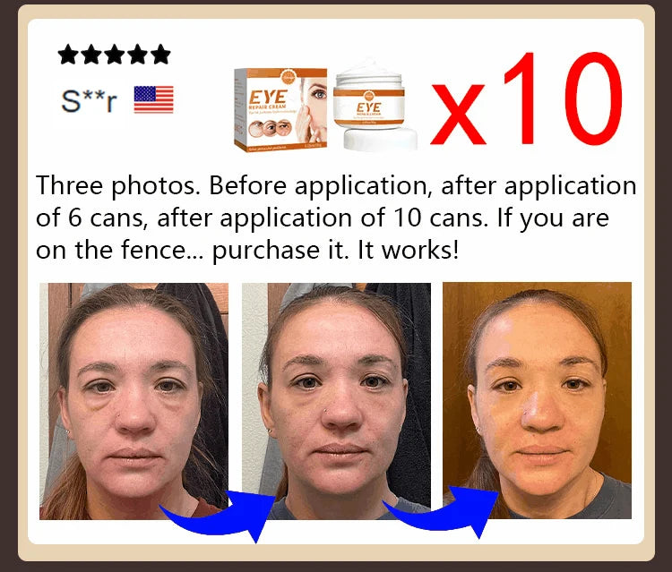 2026 New Upgraded Bestselling Eye Care Tool - Eye Revitalizing Ointment (Free Shipping)