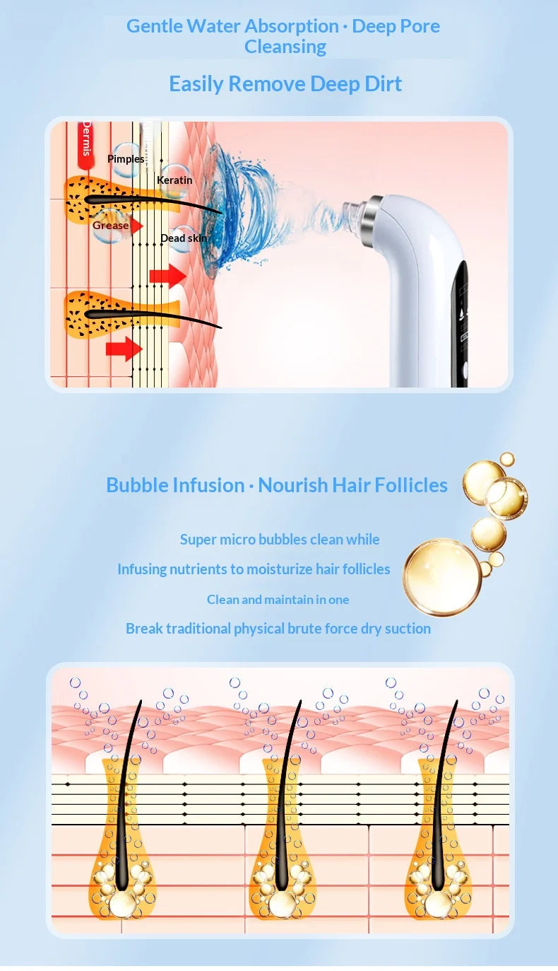 Black Pore Vacuum Remover Electric Micro Bubble Cleanser USB Recharge Beauty Device Skin Care Instrument Tool