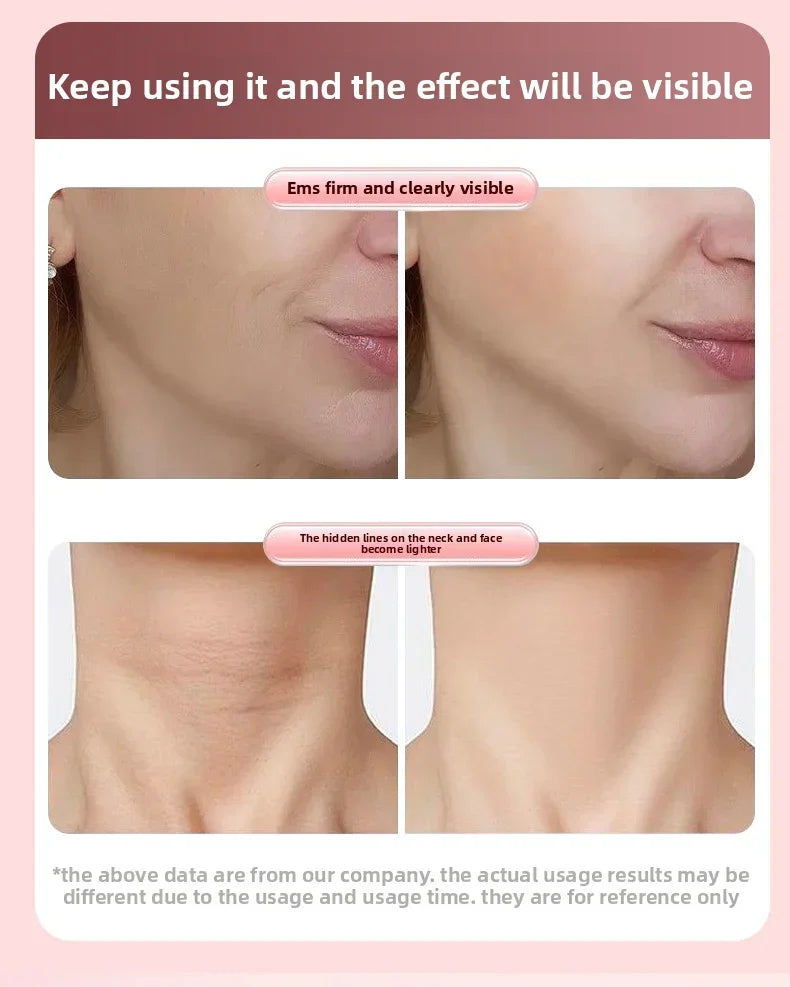 Roller Face-Slimming Artifact V-Face Beauty Facial Massager For Firming And Lifting The Face
