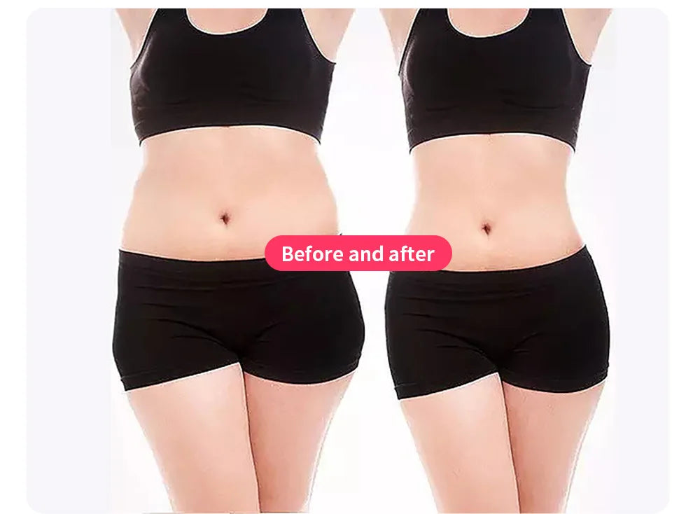 MYOslim EMS Body Sculpt Machine EMT+RF Muscle Building Fat Burning Skin Tightening 2 Handle Non-Invasive Body Shaping Device