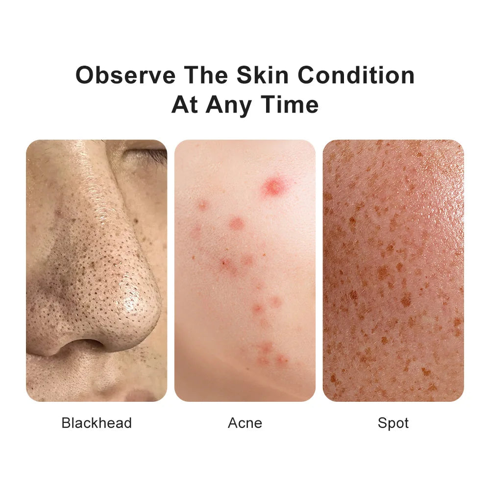Wireless Dermatoscope Scalp Skin Analyzer Machine Facial and Body Analyzer Electronics Microscope Beauty Health Profession